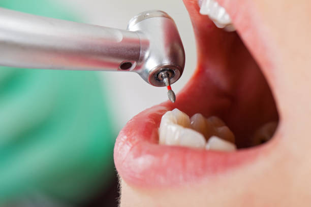 Emergency Dentist Open Today in NM